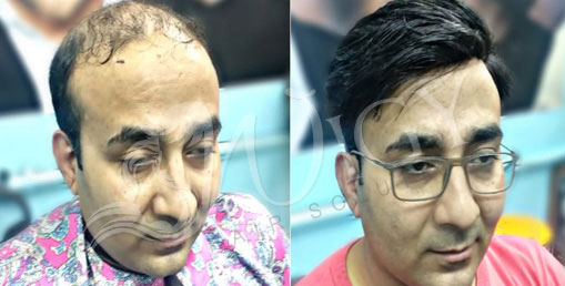 Hair Fixing Service